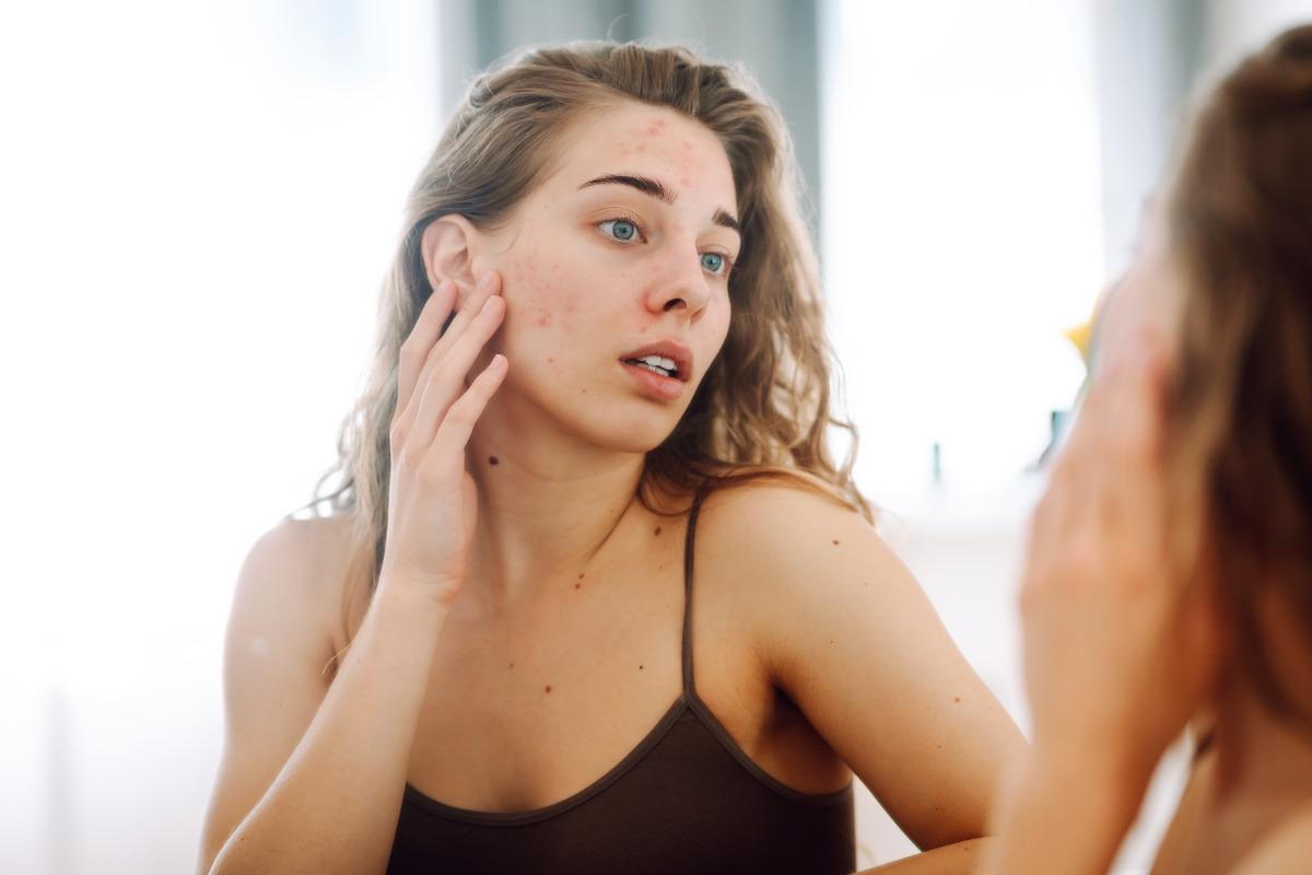 skin specialist in chandigarh